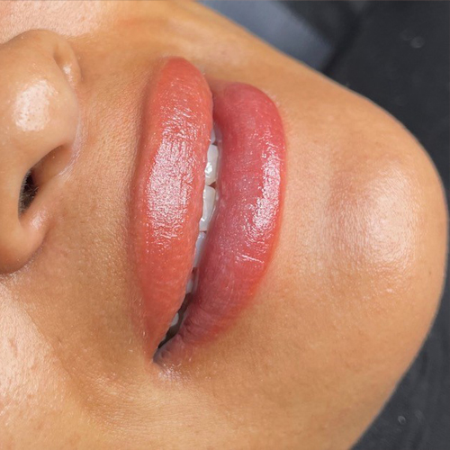 The beautylab clinic lips 3.1