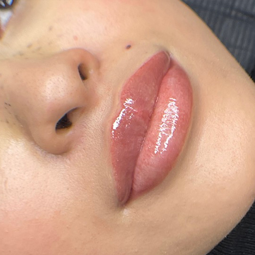 The beautylab clinic lips 4.1